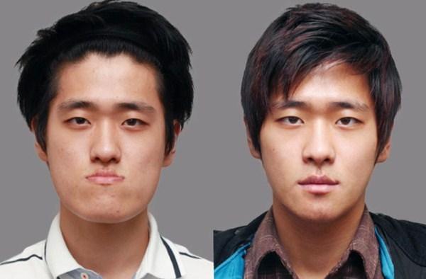 韩国人整容前后的对比照,丑男变帅男,丑女变大美女