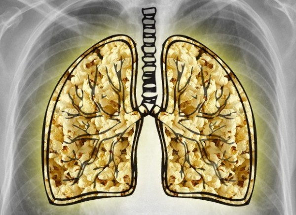爆米花肺,另类的「尘肺病」