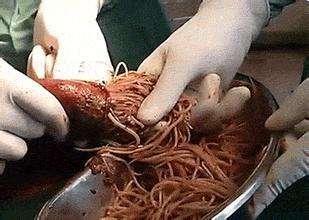 宝宝脸上有白斑,就是肚子有蛔虫吗?判断蛔虫很简单