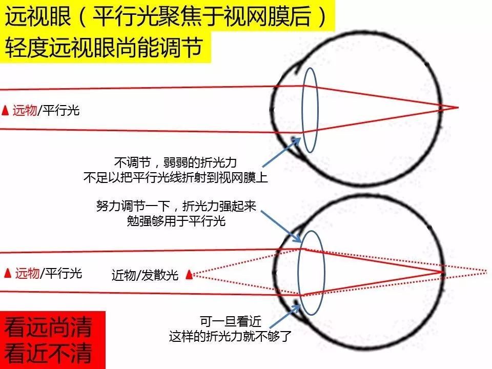 近视能看清近,远视能看清远吗?