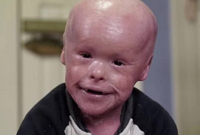 女子产下怪胎 身上长满鳞片