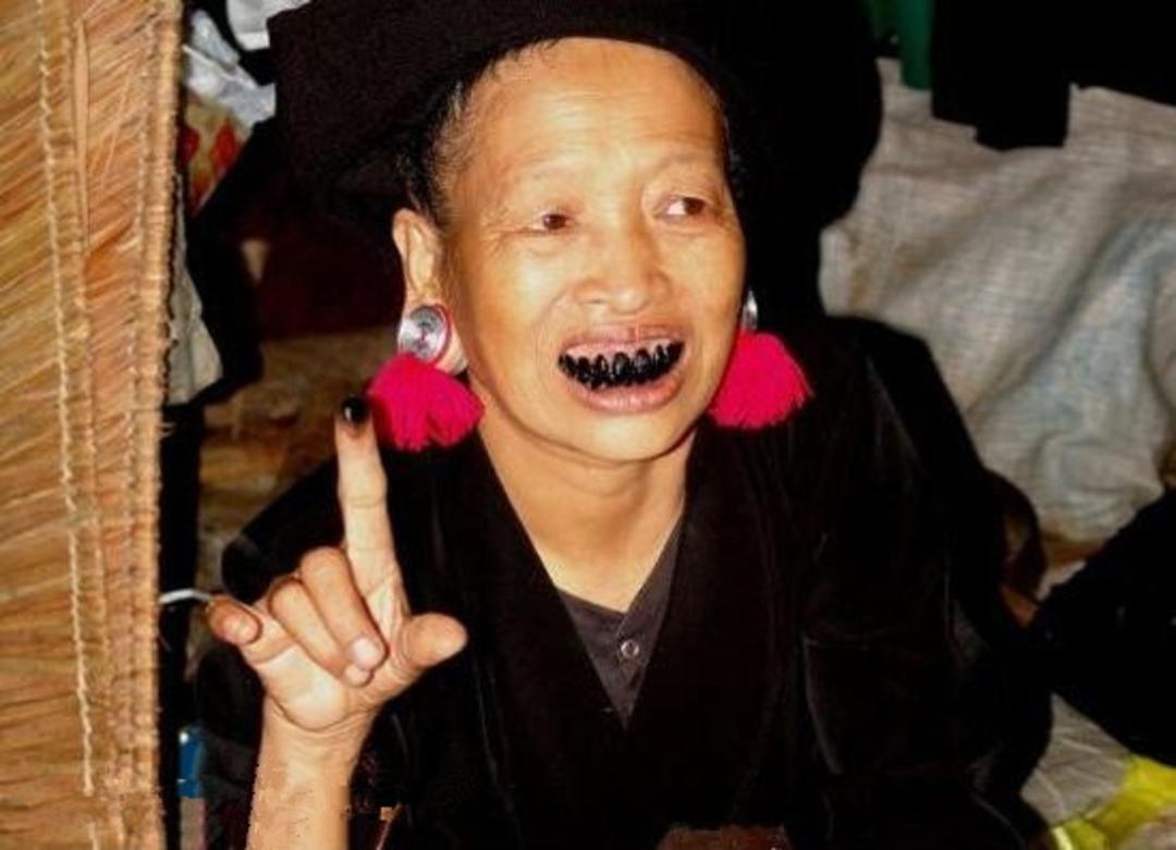 越南女人爱吃槟榔,牙齿越黑越美,提亲不要钱要槟榔