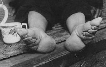 金莲 女性一般从五岁左右开始,用布将双足紧紧地缠裹,让其脚畸形变
