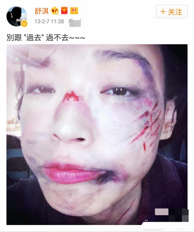 而在13年的时候,性感女神舒淇也曾在微博爆了被打照,脸上的刮花程度