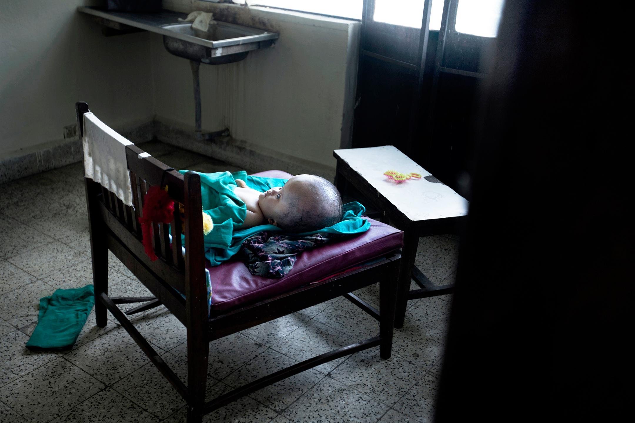 丹麦女子收养脑积水弃婴,结局却让人心酸