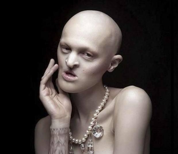 五官萎缩的她从小被人嘲笑,如今因外表红遍时尚圈!