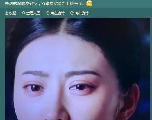 景甜"悲伤蛙"双眼皮修复完毕,颜值又回到巅峰状态了